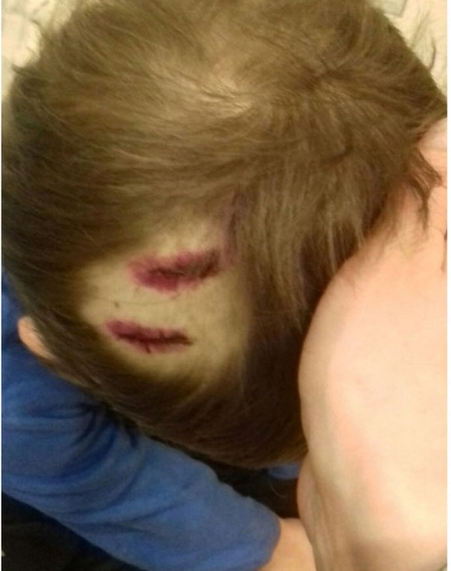 На голову четырехлетнему ребенку в Малых Колпанах упал фрагмент кирпича
