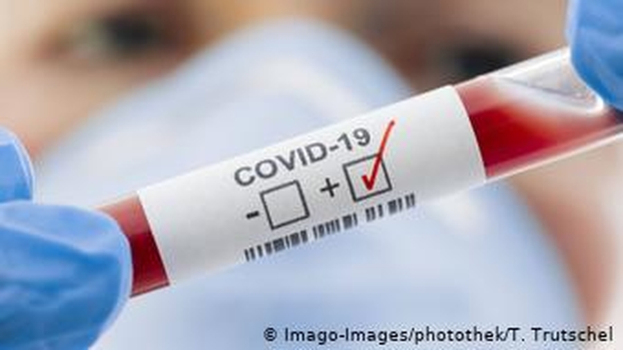20 заболевших COVID-19 в Гатчинском районе